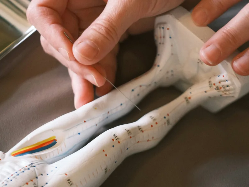 Acupuncture at Rise Family Chiropractic in Hudsonville