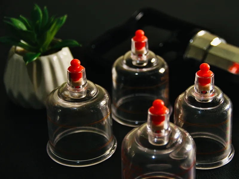 How Cupping Therapy works at Rise Family Chiropractic