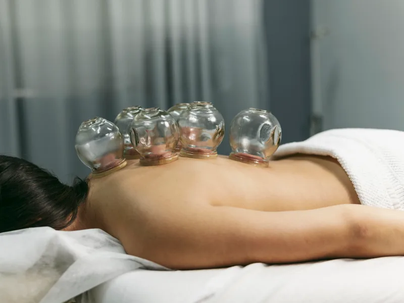 Cupping Therapy at Rise Family Chiropractic in Hudsonville