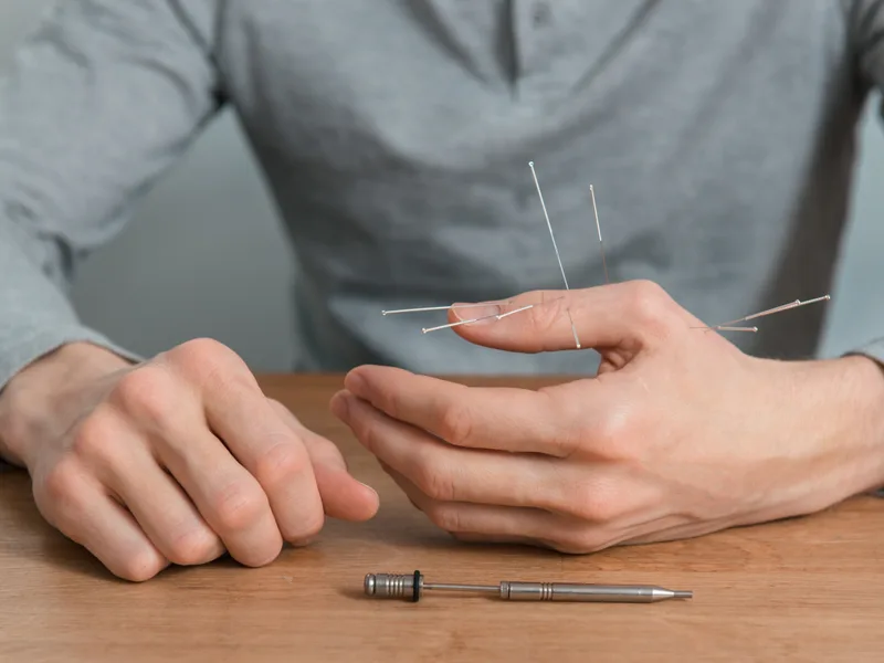 Dry Needling at Rise Family Chiropractic in Hudsonville