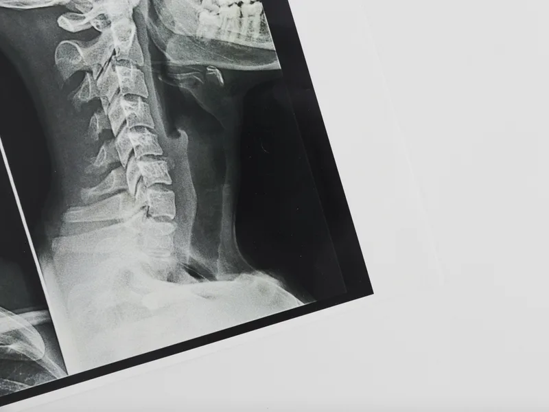 X-Rays at Rise Family Chiropractic in Hudsonville